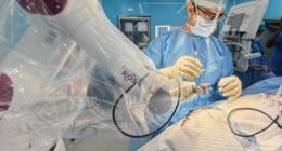 An Indian military neurosurgeon using a plastic-draped ROSA robotic assistant to perform a precise, minimally invasive brainstem biopsy in an operating room.